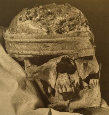 The bronze crown or head-dress found in-situ on the skull of the Mill Hill warrior