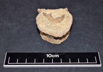 Figure 1: Large Schmorl's nodes located on the superior vertebral surface of T8 (Author’s own).