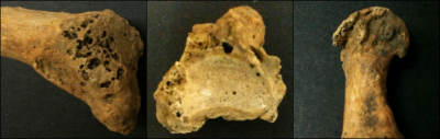 Figures 1-3 (L-R): Examples of the three main symptoms of DJD: Porosity (1), eburnation (2) and osteophytes (3) (Image Copyright: Tatiana Feuerborn)