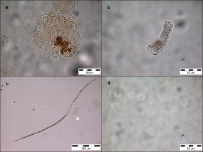 Figure 3: Selection of debris extracted from Saint Helena individuals – chewed food remains embedded in calculus (a), phytolith (b), fibre (c), starch (d (Image Copyright: Authors)